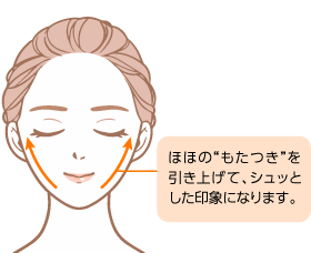 糸リフト